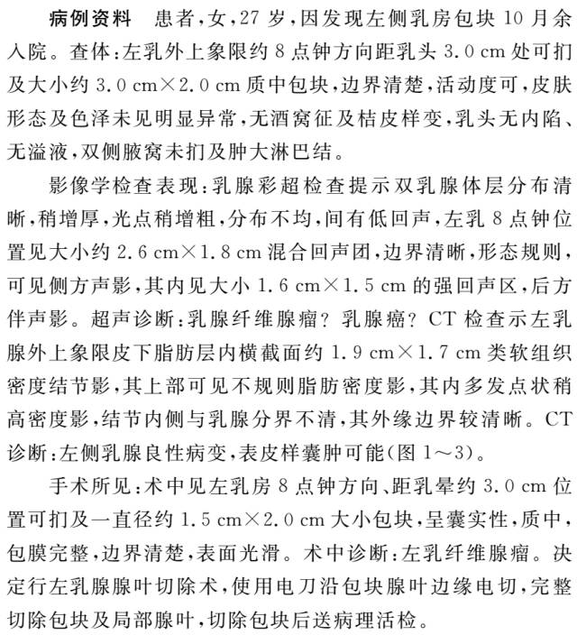 【病例】乳腺表皮样囊肿1例CT影像特点