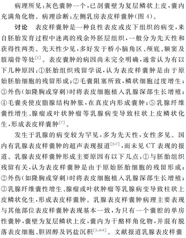 【病例】乳腺表皮样囊肿1例CT影像特点