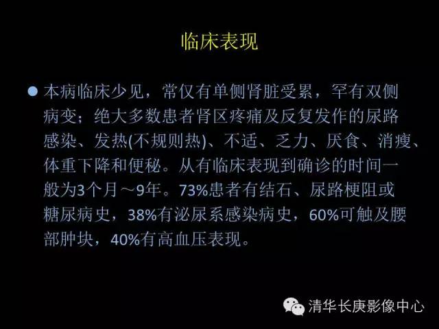 【病例】黄色肉芽肿性肾盂肾炎1例CT影像表现