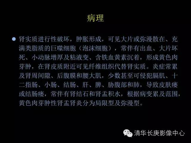 【病例】黄色肉芽肿性肾盂肾炎1例CT影像表现