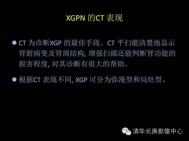 【病例】黄色肉芽肿性肾盂肾炎1例CT影像表现