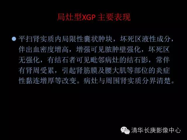 【病例】黄色肉芽肿性肾盂肾炎1例CT影像表现