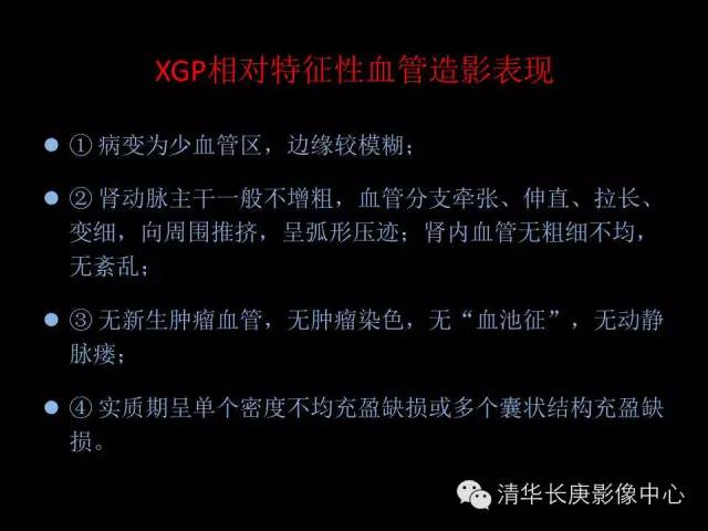 【病例】黄色肉芽肿性肾盂肾炎1例CT影像表现