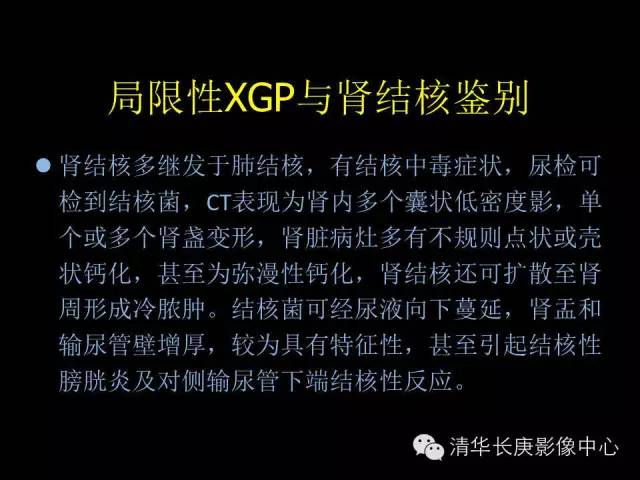 【病例】黄色肉芽肿性肾盂肾炎1例CT影像表现