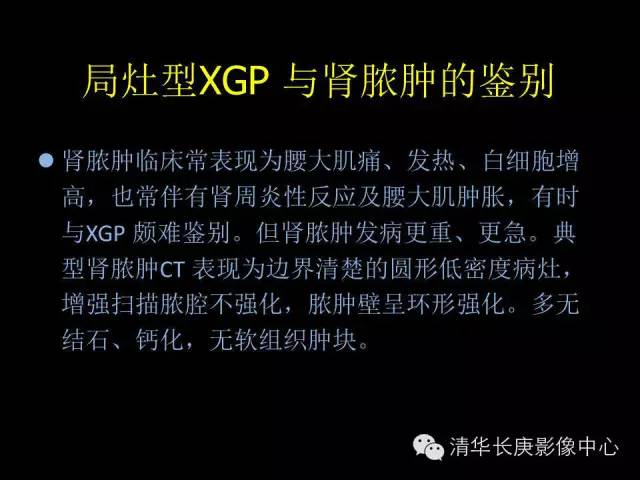 【病例】黄色肉芽肿性肾盂肾炎1例CT影像表现
