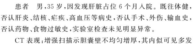 【病例】肝脏及胆囊结核1例CT影像表现