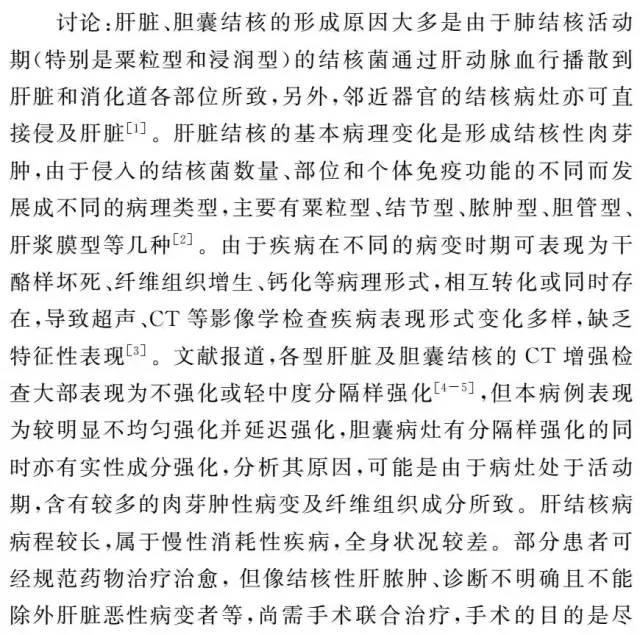 【病例】肝脏及胆囊结核1例CT影像表现