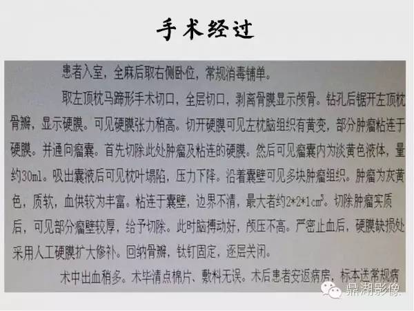 【病例】囊性脑膜瘤1例MR影像表现