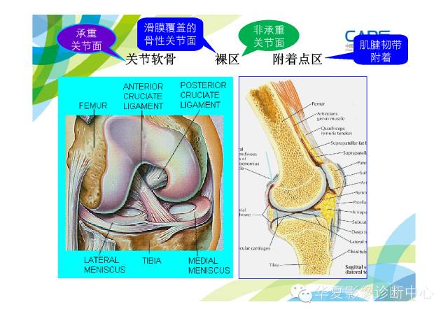 【PPT】骨肌系统影像学基本征象的再认识