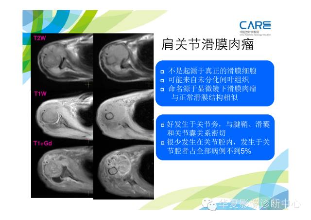 【PPT】骨肌系统影像学基本征象的再认识