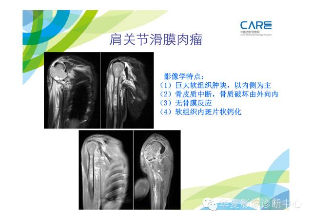 【PPT】骨肌系统影像学基本征象的再认识