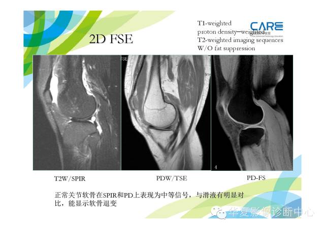 【PPT】骨肌系统影像学基本征象的再认识