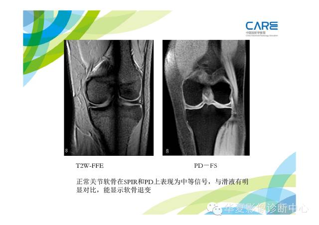 【PPT】骨肌系统影像学基本征象的再认识