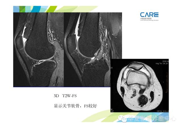 【PPT】骨肌系统影像学基本征象的再认识