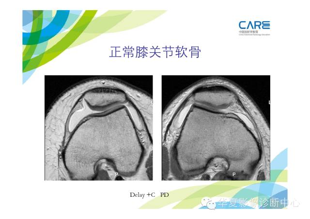 【PPT】骨肌系统影像学基本征象的再认识