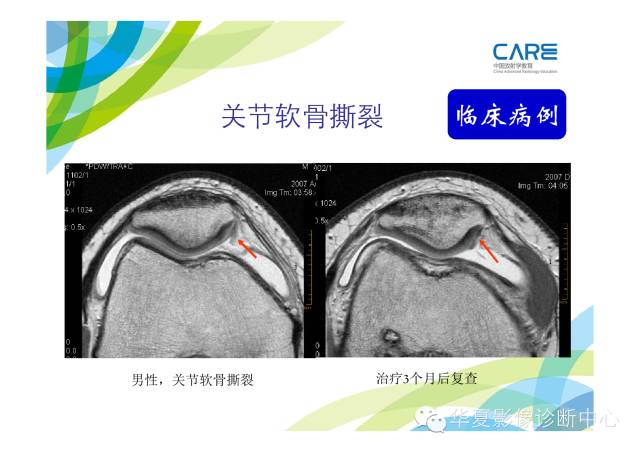 【PPT】骨肌系统影像学基本征象的再认识