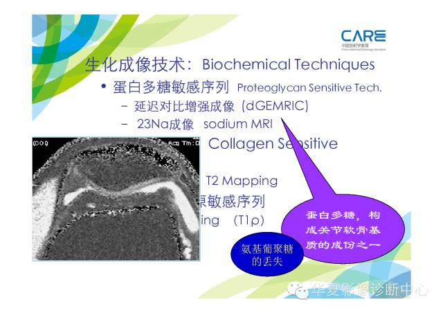 【PPT】骨肌系统影像学基本征象的再认识
