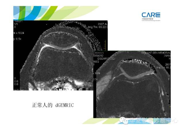 【PPT】骨肌系统影像学基本征象的再认识