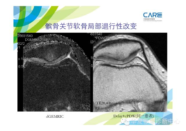 【PPT】骨肌系统影像学基本征象的再认识