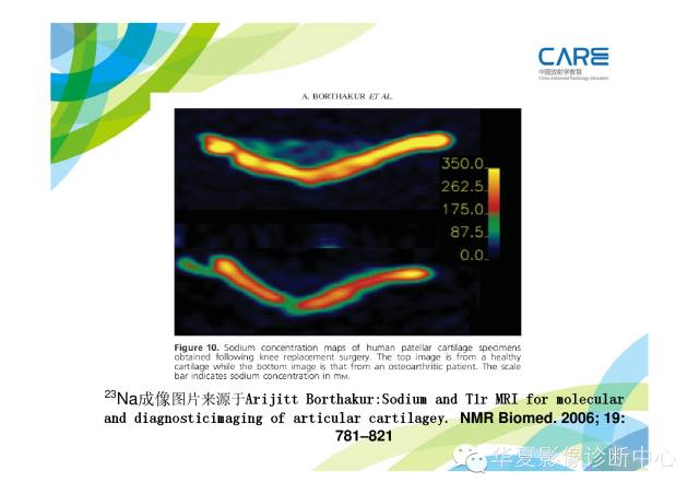 【PPT】骨肌系统影像学基本征象的再认识
