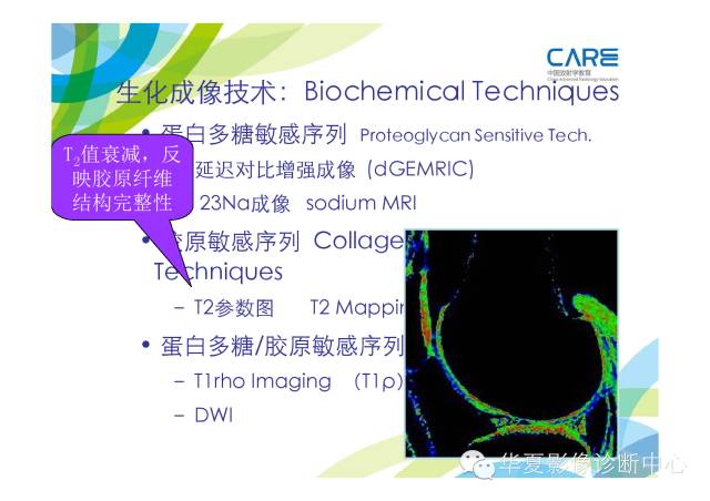 【PPT】骨肌系统影像学基本征象的再认识