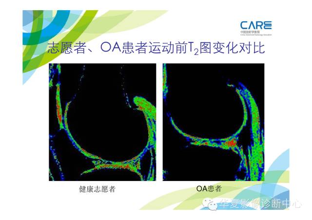 【PPT】骨肌系统影像学基本征象的再认识