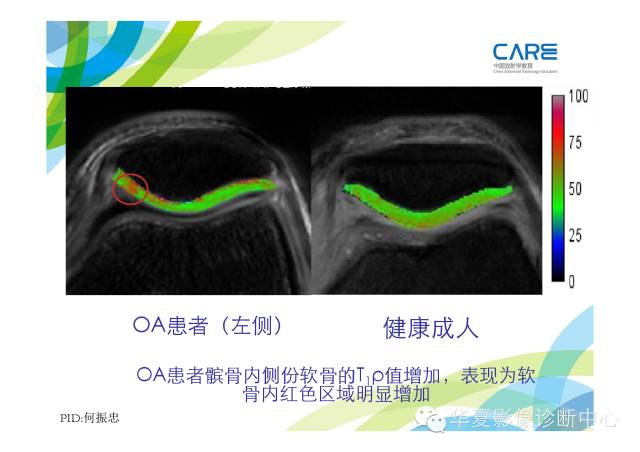 【PPT】骨肌系统影像学基本征象的再认识