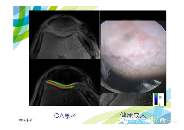 【PPT】骨肌系统影像学基本征象的再认识
