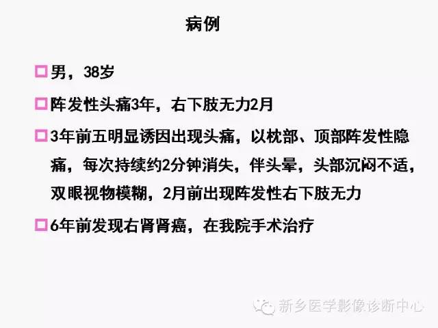 【病例】室管膜下瘤1例CT MR影像表现与鉴别
