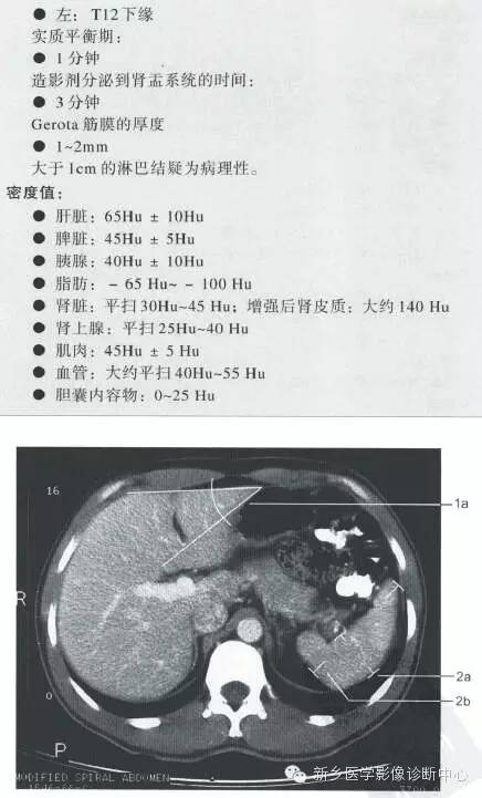 上腹部一些正常影像数据