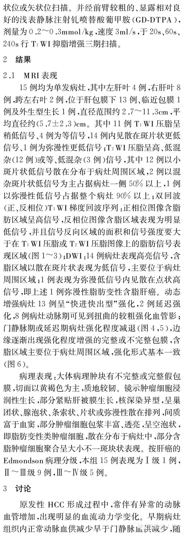 含脂肝细胞肝癌的MRI影像特点 含脂肝细胞肝癌的MRI影像特点