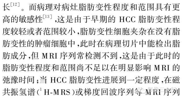 含脂肝细胞肝癌的MRI影像特点 含脂肝细胞肝癌的MRI影像特点