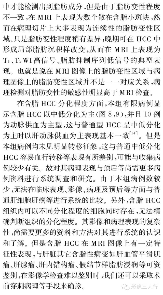 含脂肝细胞肝癌的MRI影像特点 含脂肝细胞肝癌的MRI影像特点