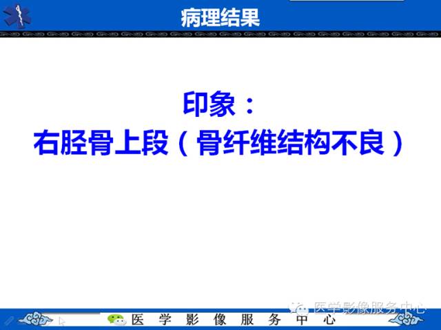 【病例】胫骨骨纤维结构不良1例MR影像表现 【病例】胫骨骨纤维结构不良1例MR影像表现