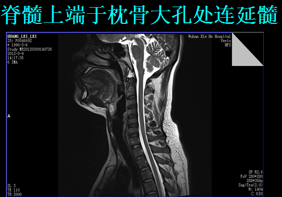 椎管解剖