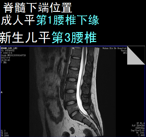 椎管解剖