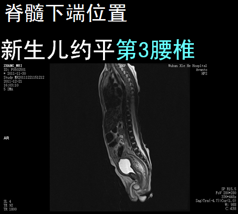 椎管解剖