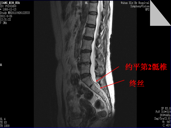 椎管解剖