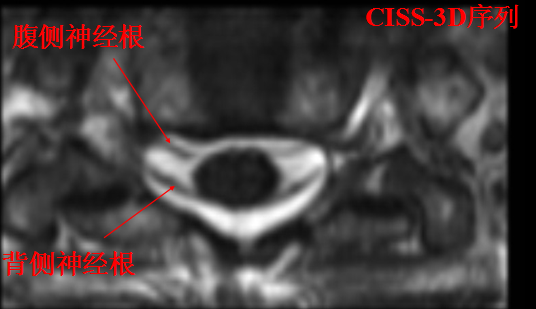 椎管解剖
