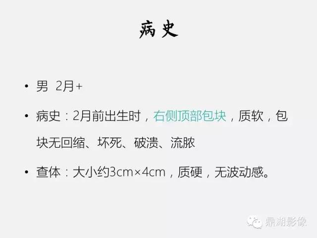 【病例】颅骨骨膜下血肿1例