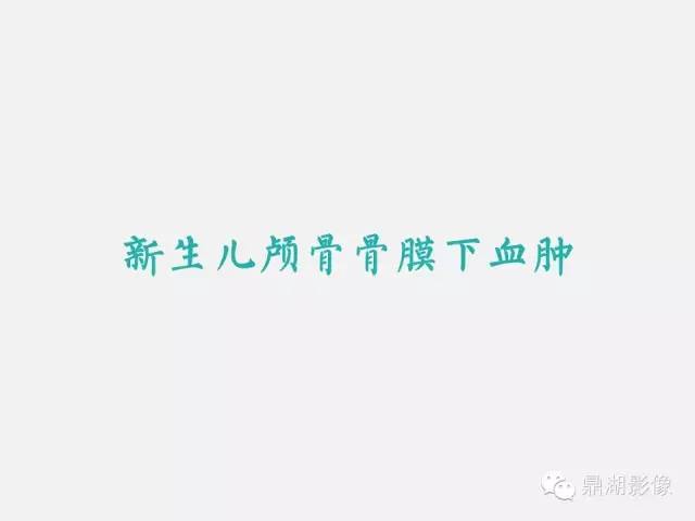 【病例】颅骨骨膜下血肿1例