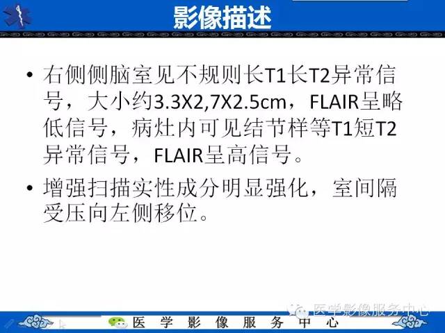 【病例】中枢神经细胞瘤1例MR影像表现
