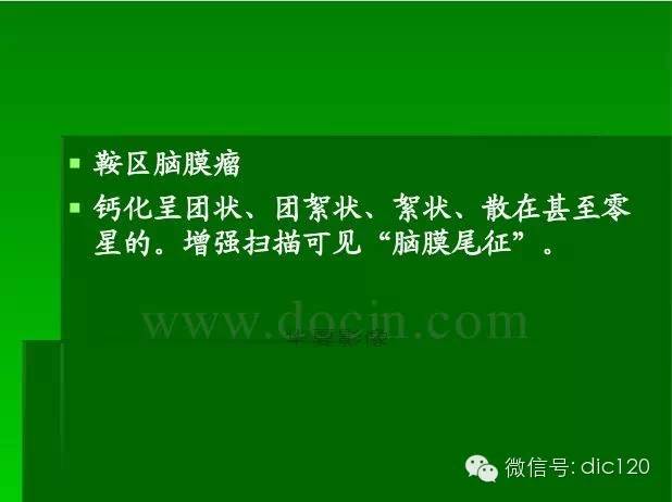 【PPT】颅内钙化影像学诊断原则和常见原因