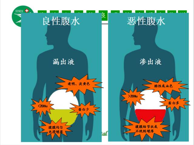 【PPT】腹腔积液的良恶性表现与鉴别