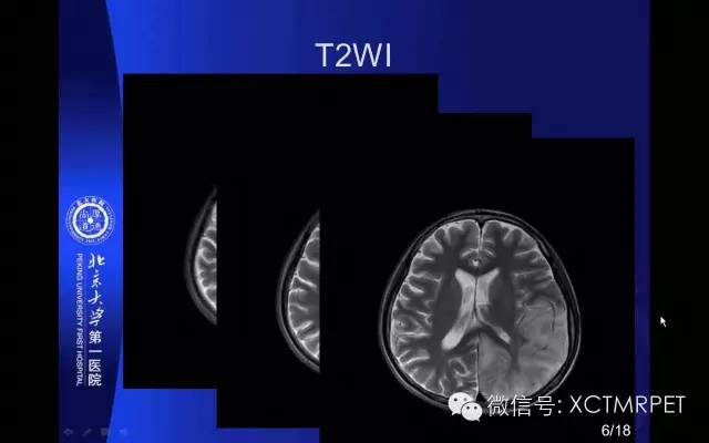【PPT】