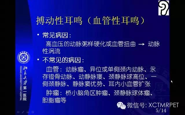 【PPT】心肌桥