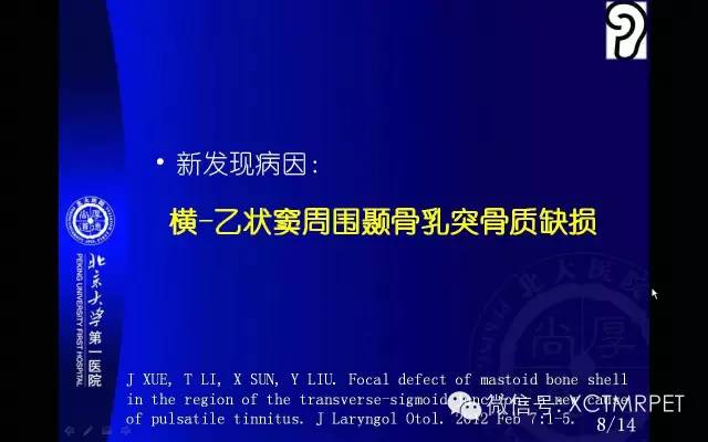 【PPT】心肌桥