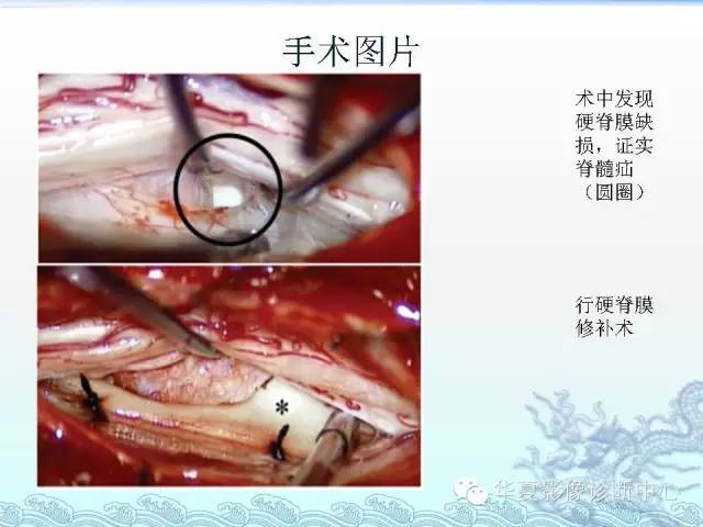 【PPT】ISCH