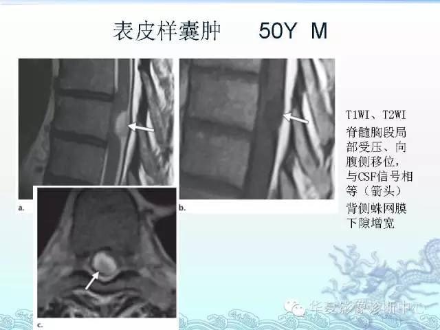 【PPT】ISCH