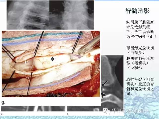 【PPT】ISCH